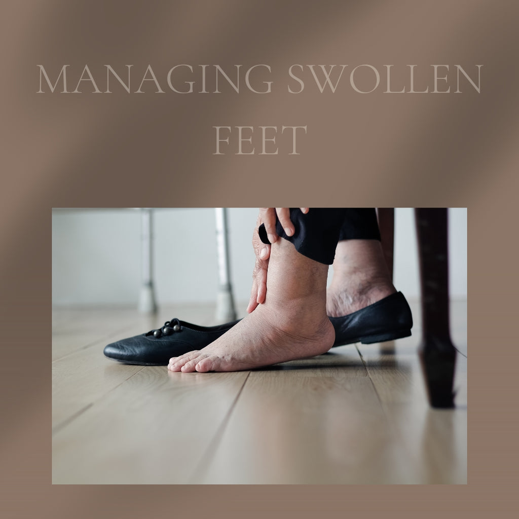 Feet Swelling In The Summer Is Normal, But You Don't Have To Live With It